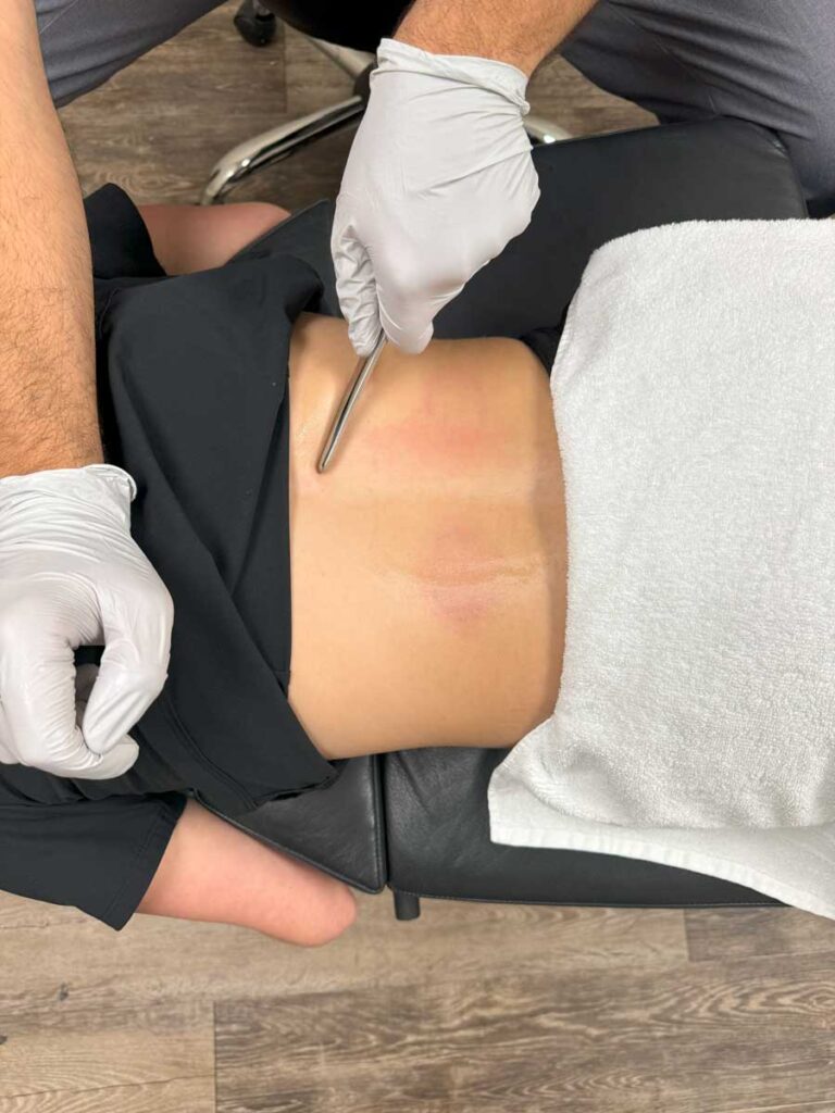 manual therapy technique